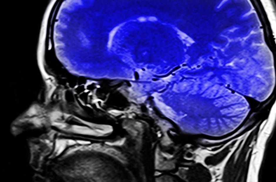 Bridgeway Center, Inc. will have mental health training courses available at the end of March. [Pixabay.com]