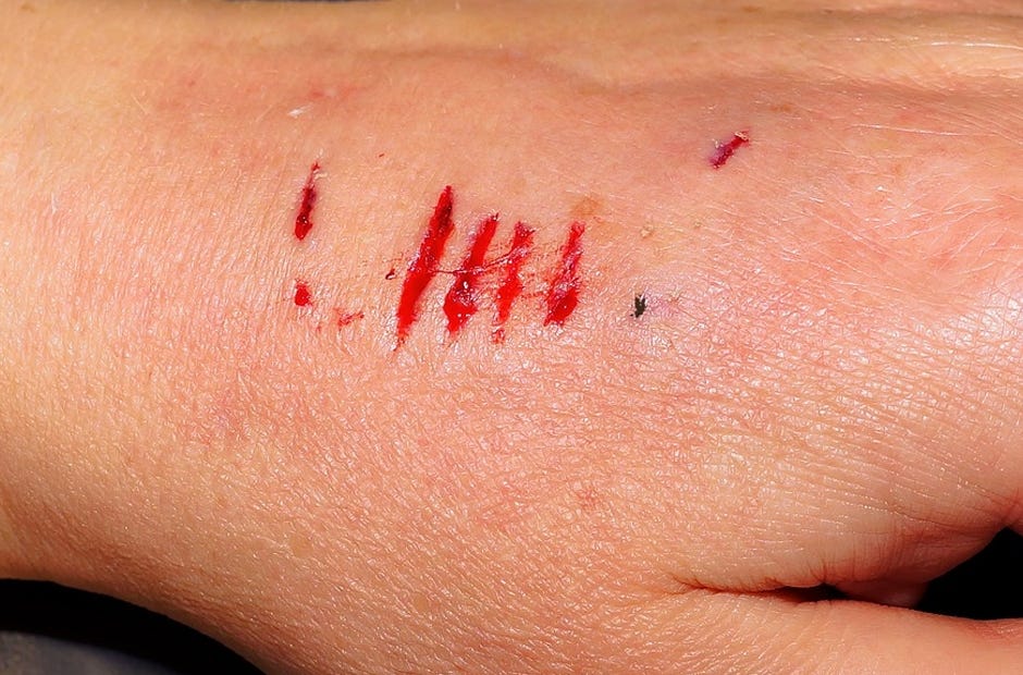 Persons who have been bitten or scratched by wild or domestic animals should seek medical attention and report the injury to the Okaloosa Department of Health at 833-9065. [Pixabay.com]