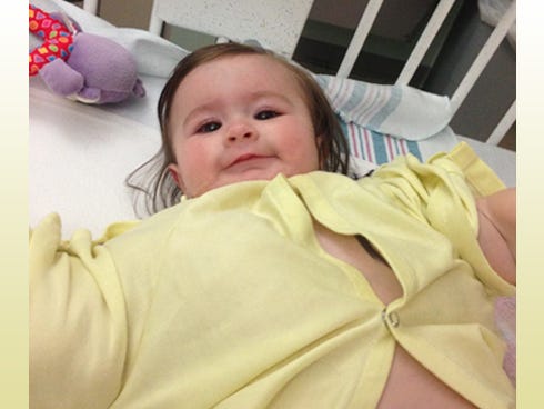 Joni and Kyle Gatlin have started a GoFundMe.com account to raise $5,000 for their daughter, Madison’s, expenses for a rare medical disorder. The five-month-old girl is one of about 150 people worldwide with CLOVES syndrome.