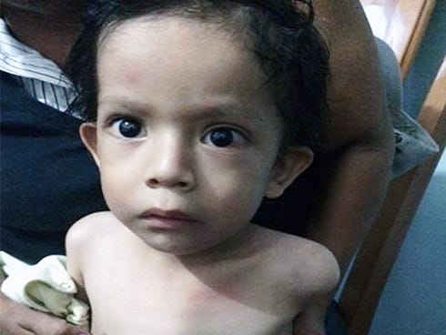 Operation Medical Care, a Crestview-based nonprofit, seeks donations to cover Belizean toddler Julio Chi’s transportation to Okaloosa County for corrective surgery. Local doctors will perform the operation at no cost.